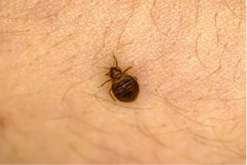  HOW LONG DO BED BUG BITES STAY RED?