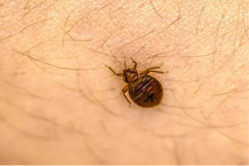 HOW LONG DO BED BUG BITES STAY ON YOUR BODY?