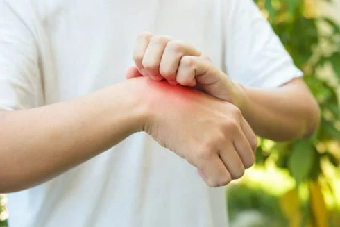 HOW LONG DO BED BUG BITES STAY ITCHY?