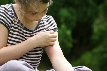 DO BED BUGS LEAVE BITES?