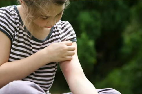 HOW LONG DOES IT TAKE TO GET RID OF BED BUG BITES?