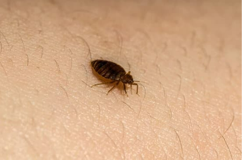 CAN YOU SEE BED BUGS CRAWLING ON YOUR SKIN?