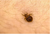 HOW TO IDENTIFY BED BUG BITES