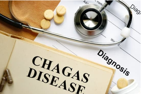 CHAGAS DISEASE