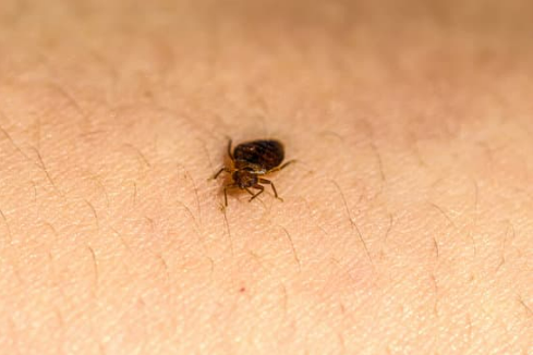 DO BED BUGS LAY EGGS ON THE HUMAN BODY