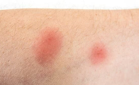 Where do Bed bugs come from