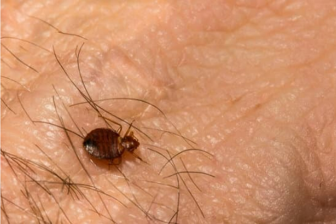 BEST BED BUG REPELLENT KILLER