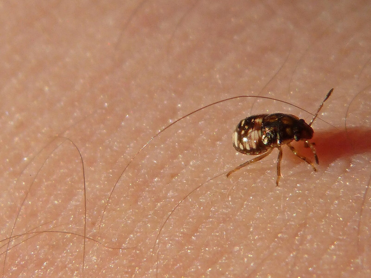 Best Home Remedies for Flea Bites