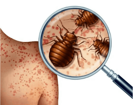 Why do bed bugs bite?