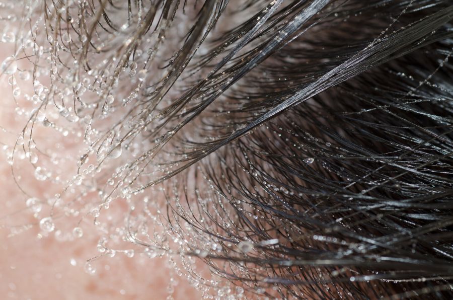 Will bed bugs bite your scalp?